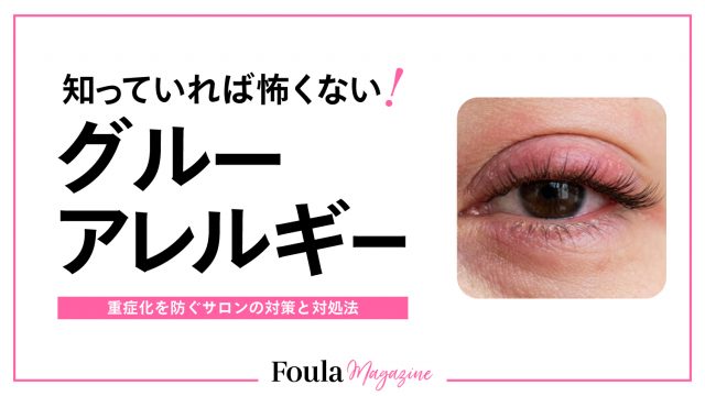 知っていれば怖くない！グルーアレルギー