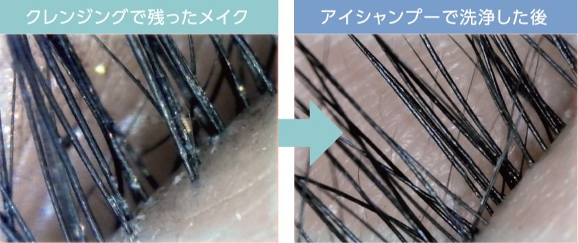アイシャンプーを使用する前と使用した後におけるまつ毛の根元の比較