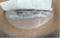ラッシュリフト2液塗布量画像